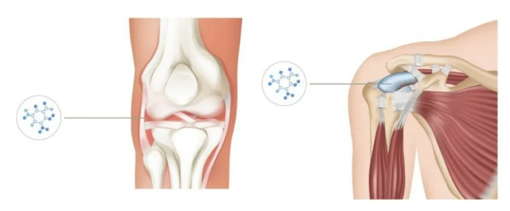 Viure sense dolor, els avantatges del tractament amb PRP