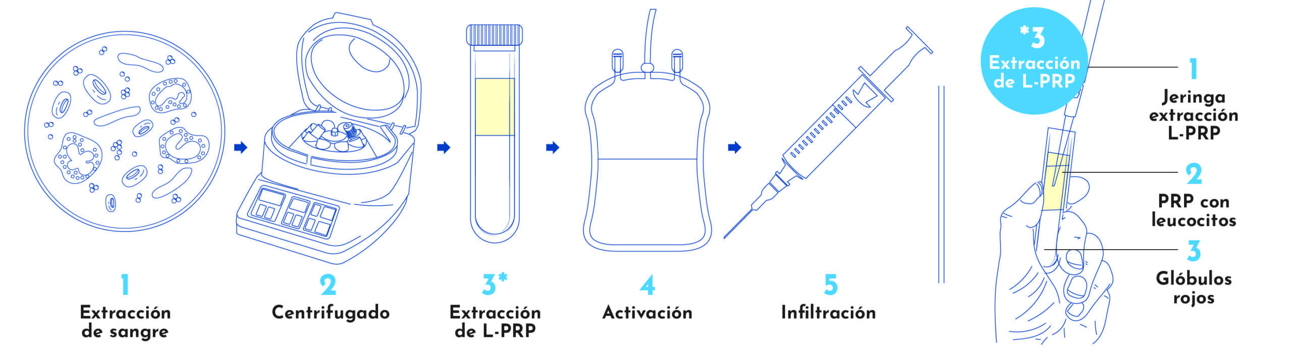 Proceso de extracción de L-PRP