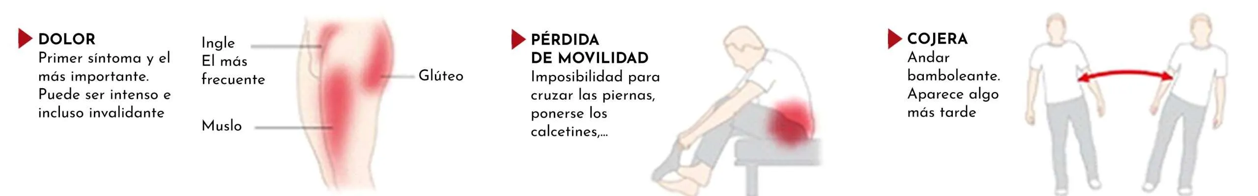 Artrosis de maluc: causes, símptomes, consells i tractaments