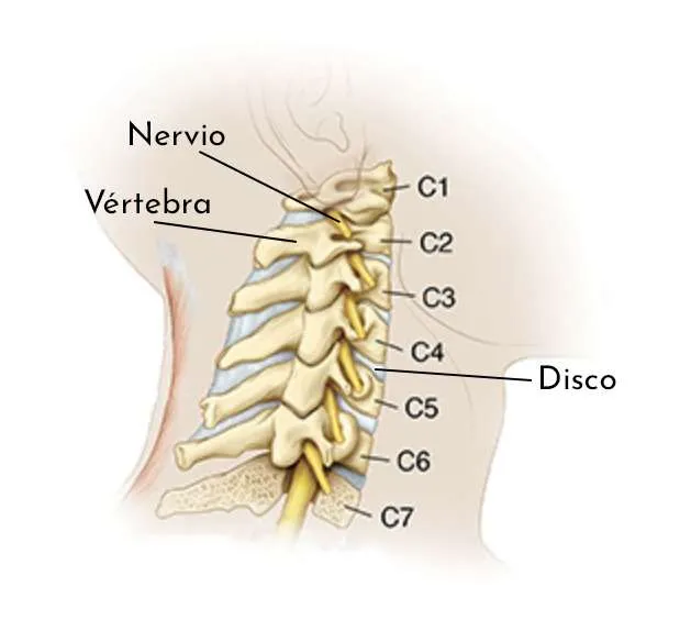 Cervicàlgia crònica: què és i com la tractem