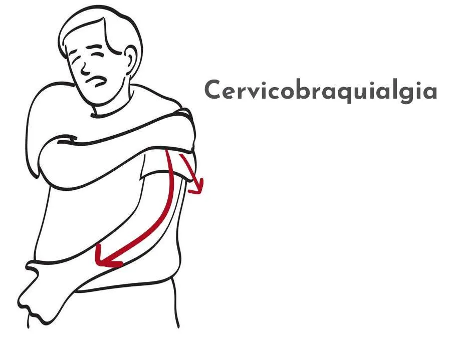 Cervicàlgia crònica: què és i com la tractem