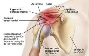 TENDINITIS DE L'ESPATLLA