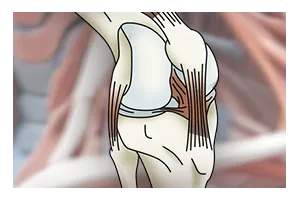Rodilla