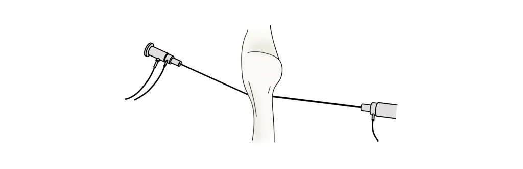CONDROPATIA ROTULIANA
