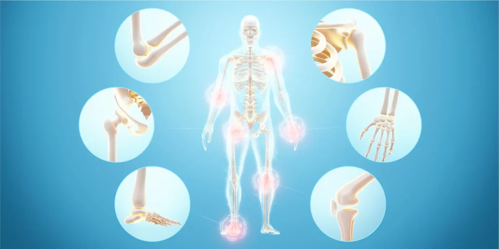 Artrosi i dolor crònic: causes, símptomes i solucions
