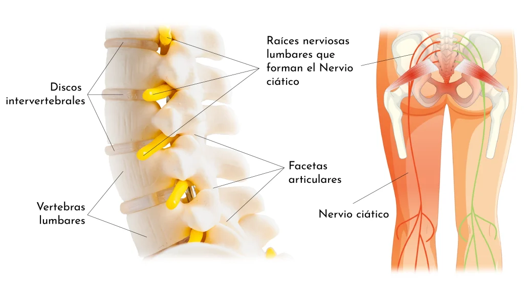 protrusiones-hernias-discales-anatomia-unidad-dolor-grup-policlinic
