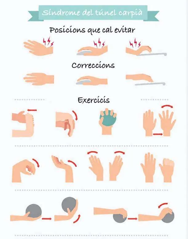 10 senzills exercicis per millorar el teu Síndrome del Túnel Carpià (STC)