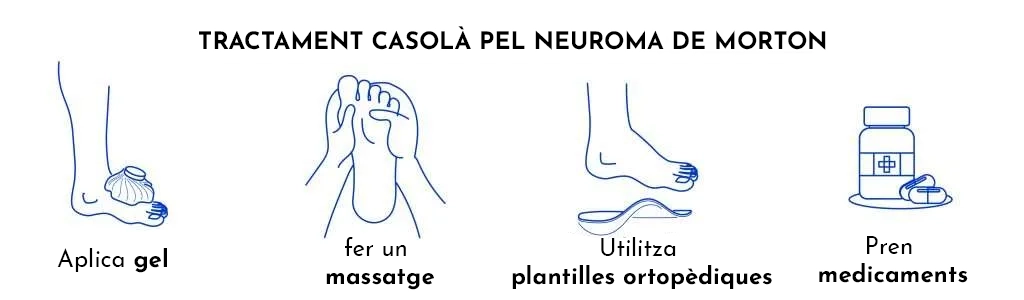 Neuroma de Morton