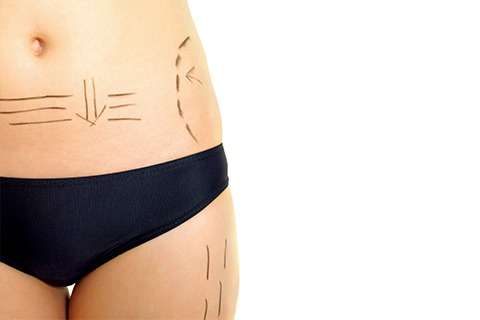Abdomen