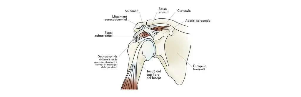 Pinçament de l’espatlla