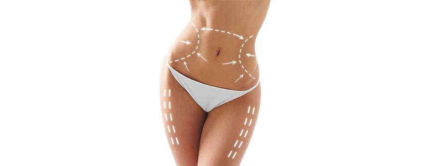 Lipoescultura