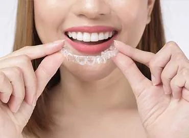 Ortodòncia tradicional i invisible Invisalign