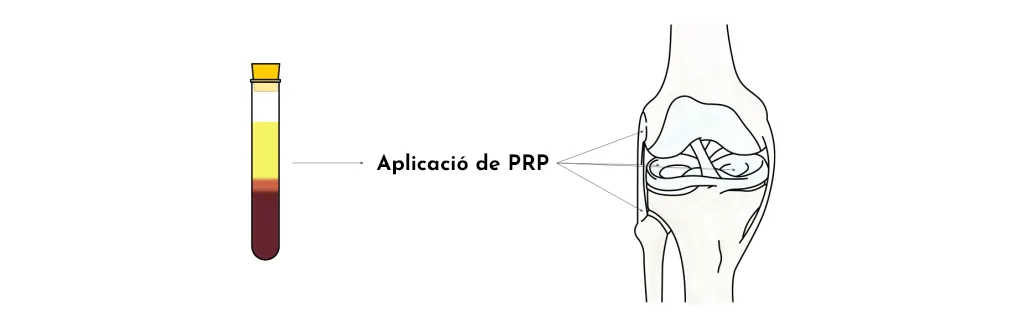 CONDROPATIA ROTULIANA