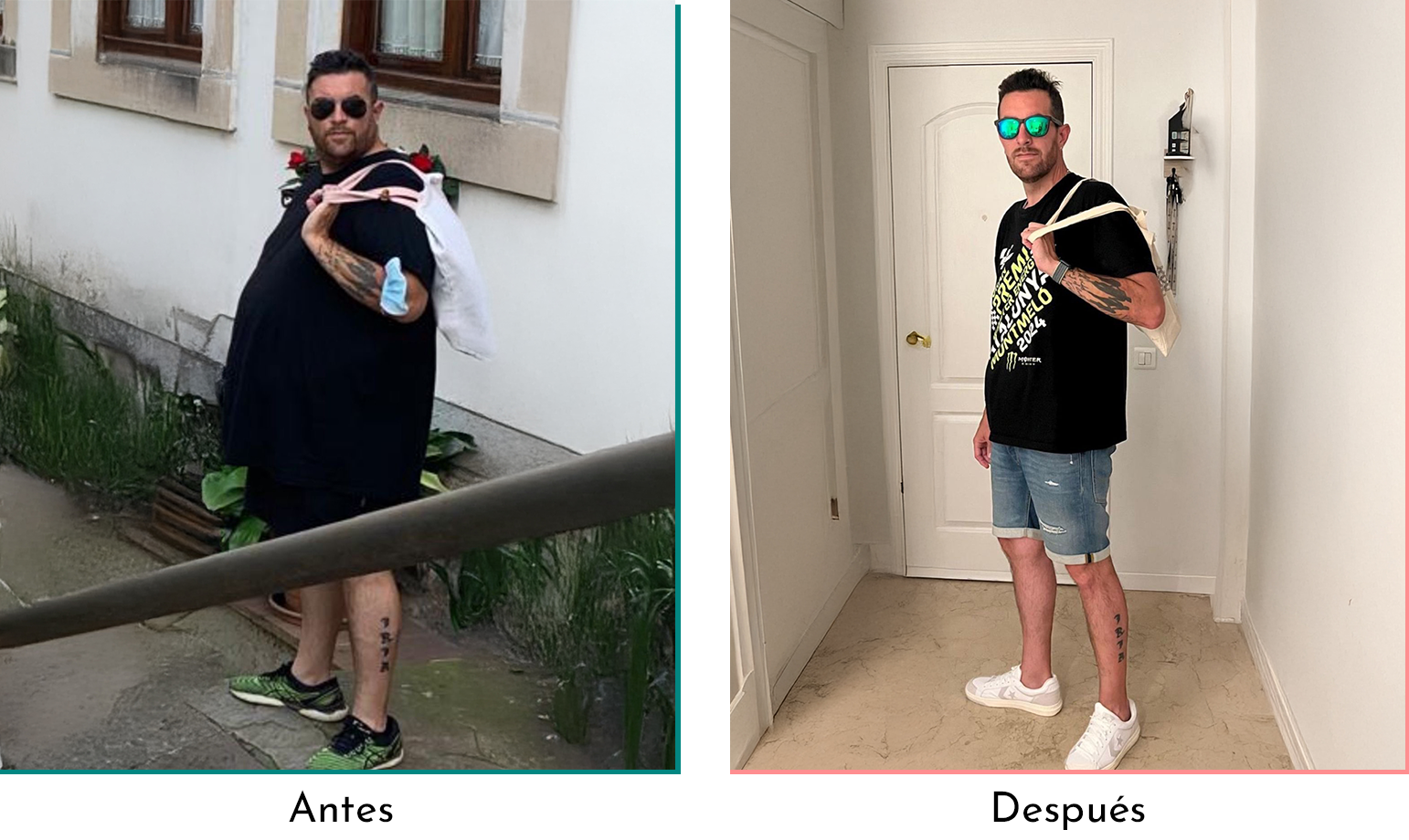 Transforma la teva vida amb la cirurgia bariàtrica