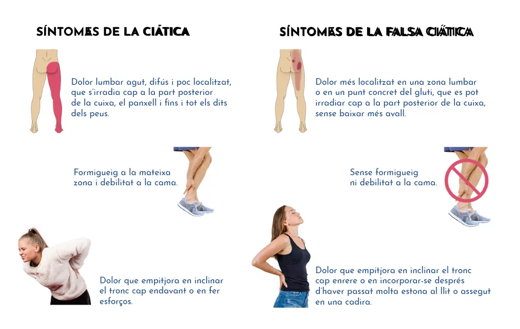 LUMBÀLGIA PER SÍNDROME FACETARI LUMBAR