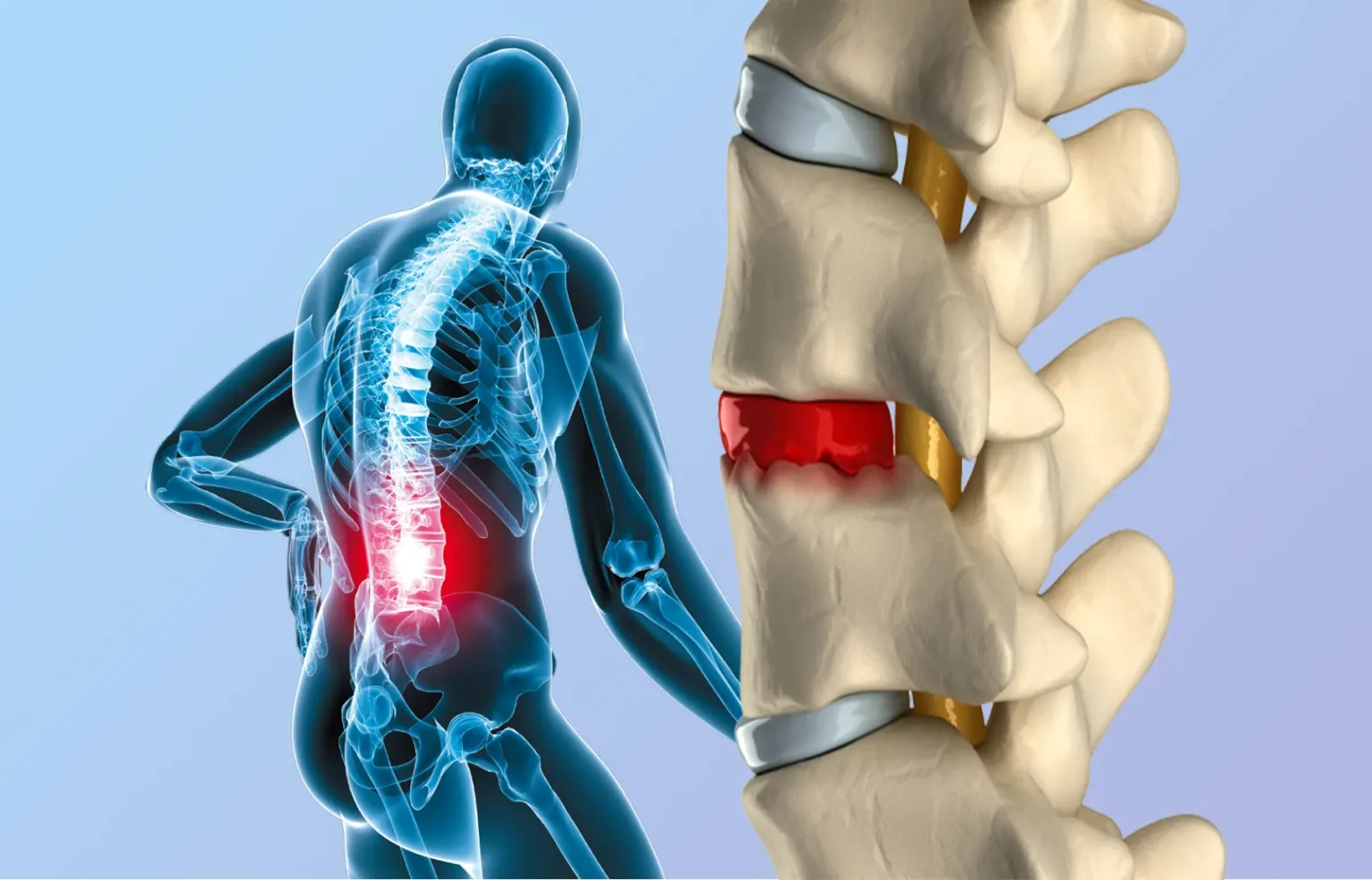 FAQ-protusions-hernias-discals-ciatica-grup-policlinic