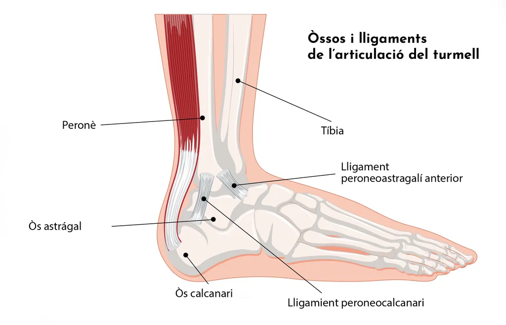 Esquinç agut de turmell: tipus, símptomes i tractaments
