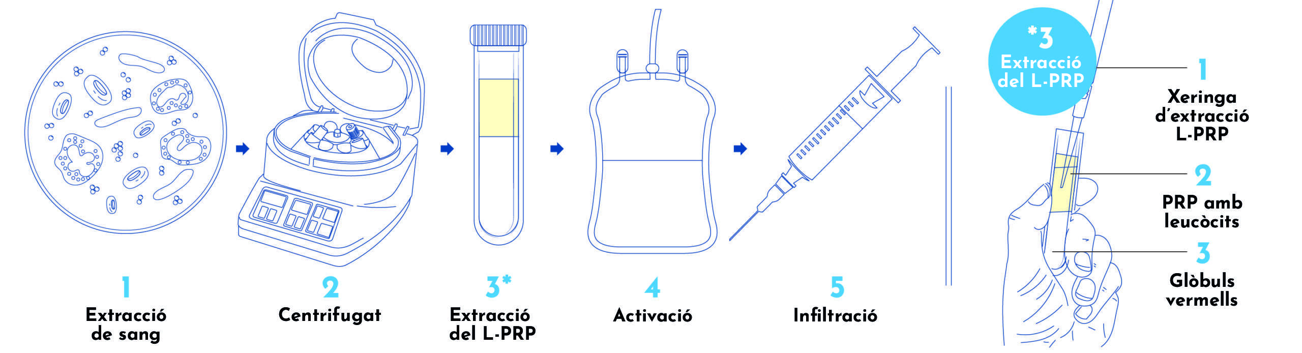 L-PRP