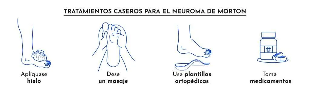 Neuroma de Morton