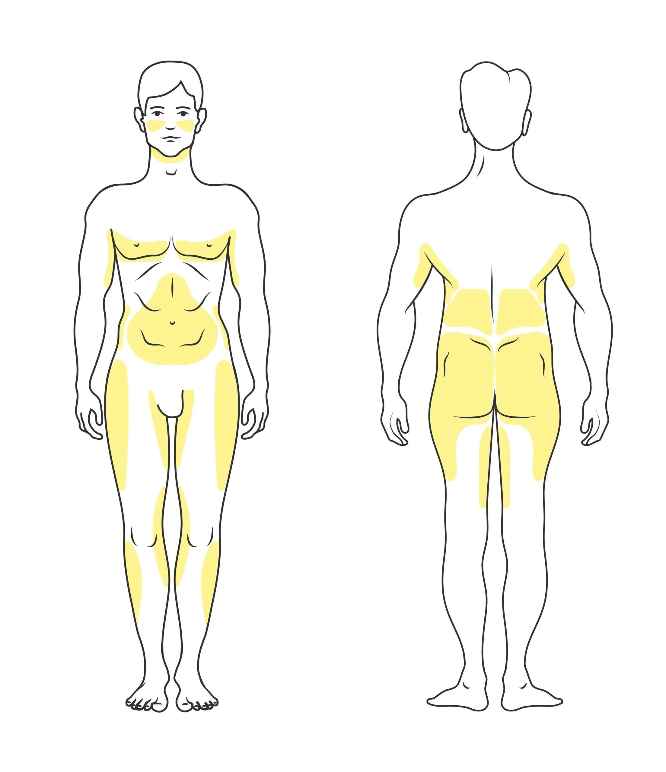 Liposucción sin cirugía hombres