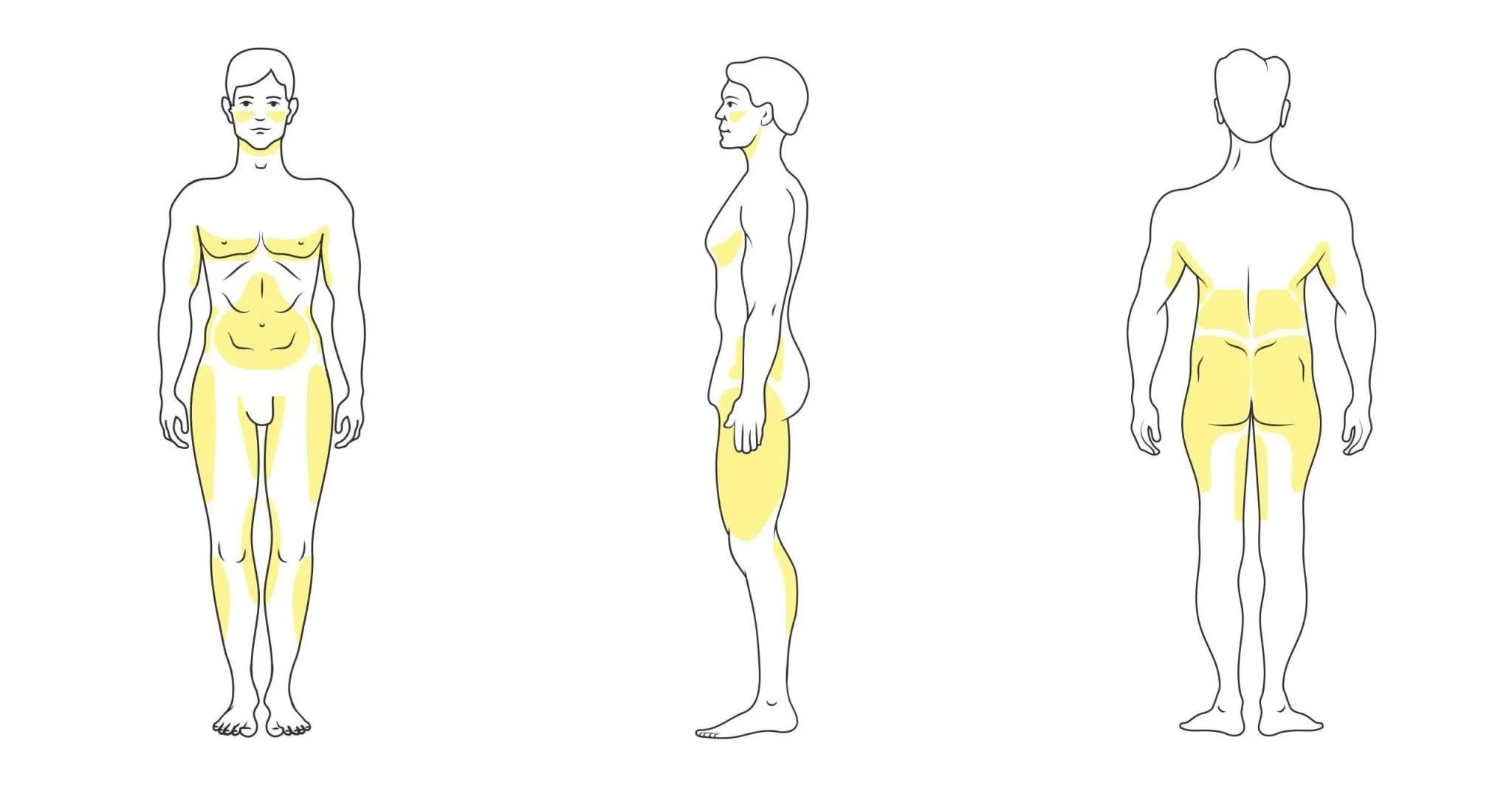 Liposucción sin cirugía hombres