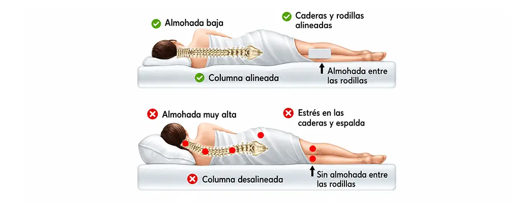 Artrosis: 10 consejos para vivir mejor y 10 errores a evitar