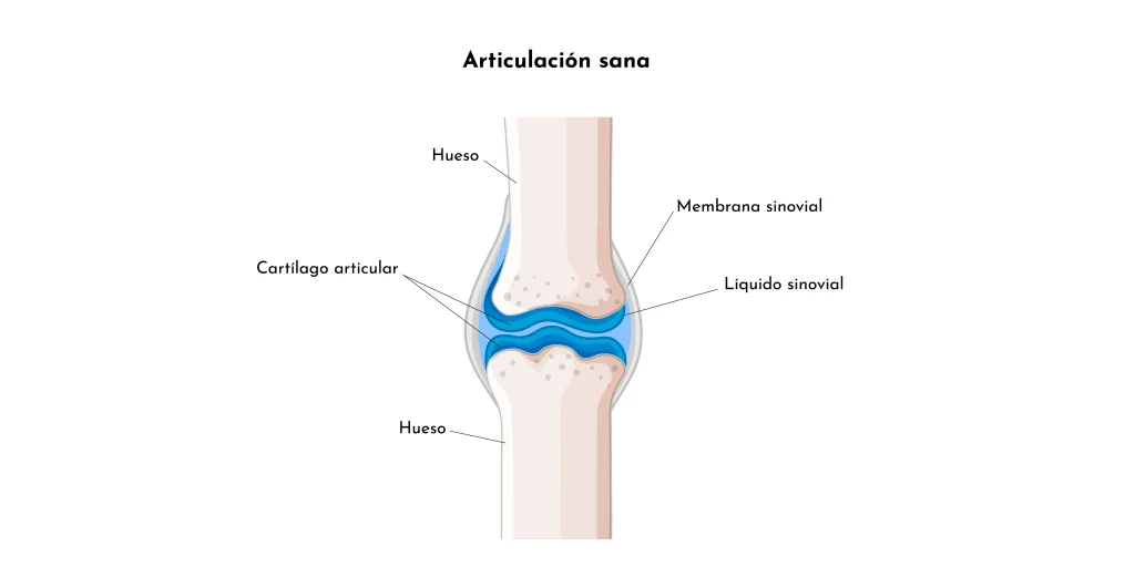 articulacion-sana_Artrosis-dolor_cronico_Causas_sintomas_soluciones